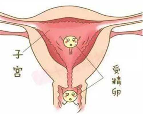 东莞找代孕有哪些风险_孕妇滥吃过胖有风险!