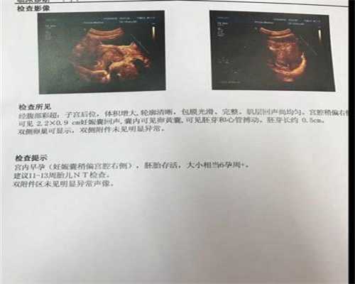 深圳最新 代孕QQ群_避孕药危害有哪些 女性在什么时候不宜吃避孕药