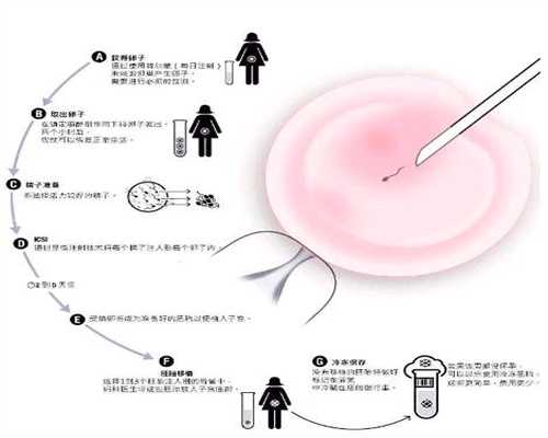 深圳代孕条件，深圳有代孕的地方吗，正规深圳代孕生小孩联系方式