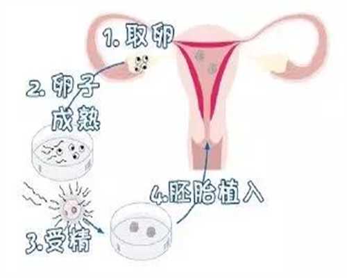 代孕是怎样代的-代孕志愿者价格-产后子宫下垂怎么预防 子宫恢复需要多久